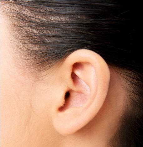 神经性耳鸣最佳治疗方法？神经性耳鸣怎么治效果好？__凤凰网