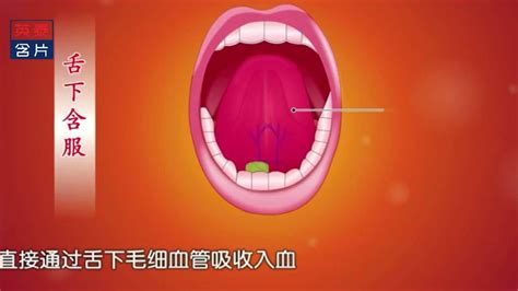 六、舌瓣法-整形美容手术-医学