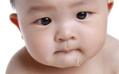 脑瘫宝宝一直流口水是怎么回事儿？