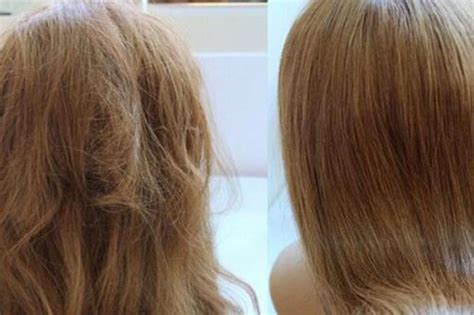 【图】女性头顶头发稀疏的原因有哪些呢 解密头顶头发稀少怎么办(3)_女性头顶头发稀疏_伊秀美容网|yxlady.com