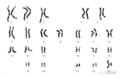 染色体组型分析_360百科