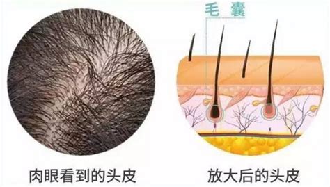 头发周期和头发生长周期的说明-翻译：早期生长阶段、中间生长阶段、后期生长阶段、回归阶段、休息阶段、脱