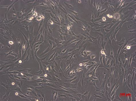 MDA-MB-175-VII细胞ATCC HTB-25细胞 MDAMB175VII人乳腺导管癌细胞株购买价格、培养基、培养条件、细胞图片、特征 ...