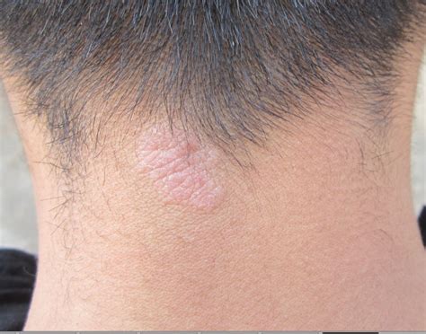 皮肤瘙痒，竟暗藏肿瘤！这些可能是疾病信号_科普中国网