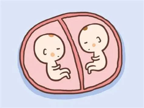 别再说双胞胎胎停总误诊，超过9周没胎心那才是真停育_家庭医生在线