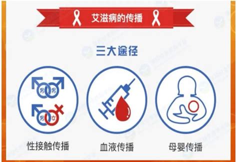 艾滋病传染必须有五个条件-艾滋病的初期症状和身体反应-如何预防艾滋病