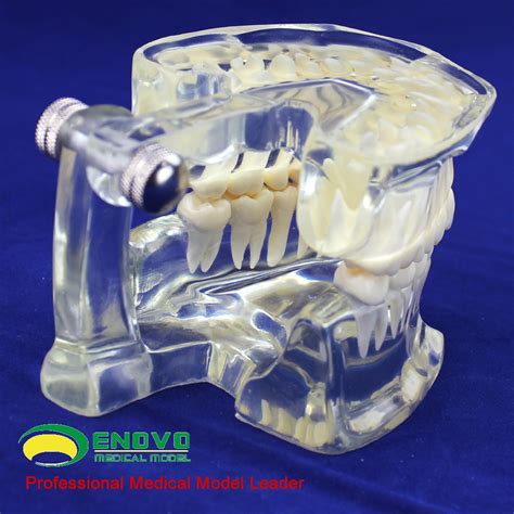 透明成人标准牙齿模型 标准齿模 牙科礼品 牙列展示 口腔模型-阿里巴巴