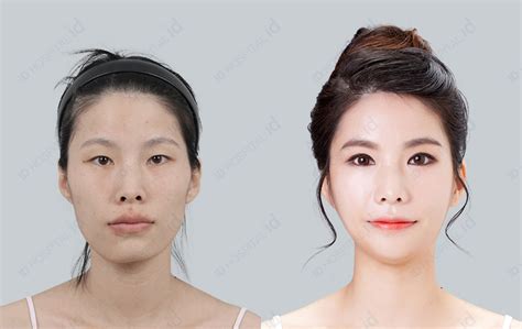 美女做面部整容手术画线元素素材下载-正版素材401778475-摄图网