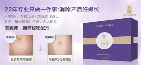 去妊娠纹最好的产品 祛纹达人极力推荐【美体】_风尚网|FengSung.com