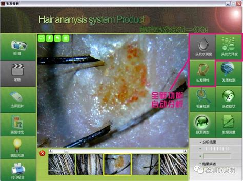 头皮测试仪 头皮护理仪头发护理仪头皮护理养发仪器头发智能测试-阿里巴巴