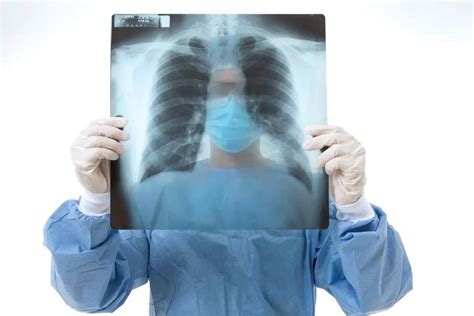 肺癌手术怎么做 肺癌手术方式有哪些_中华康网