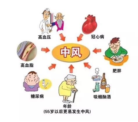 预防中风的方法，每个中老年人都应该知道！不用吃药，简单实用_湛江市第二中医医院