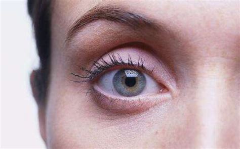 右眼皮跳是什么预兆-右眼跳是什么预兆-右眼跳是怎么回事