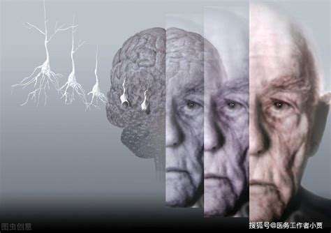 阿尔兹海默症老人为什么更能记起年轻时的事情？ - 知乎