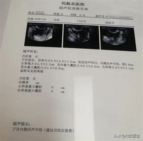 B超检查“子宫内膜回声不均”，我到底得了什么病？|回声|月经|子宫|-健康界